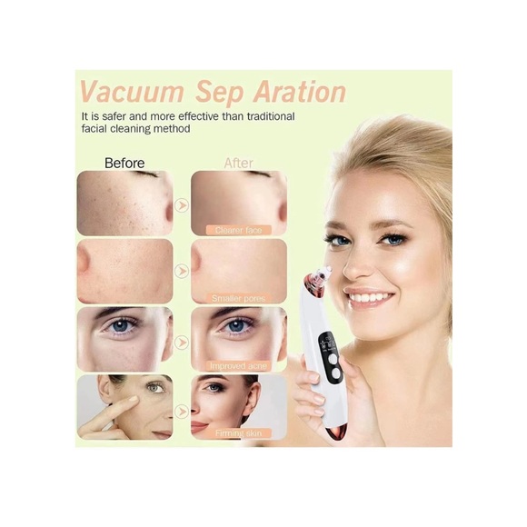 Blackhead Instrument - Picture 2 of 5